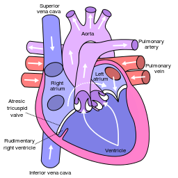 blue baby syndrome - Dr. Kaushik Mukherjee